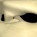 Osteopenia/Osteoporosis