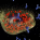 What is Mastocytosis?